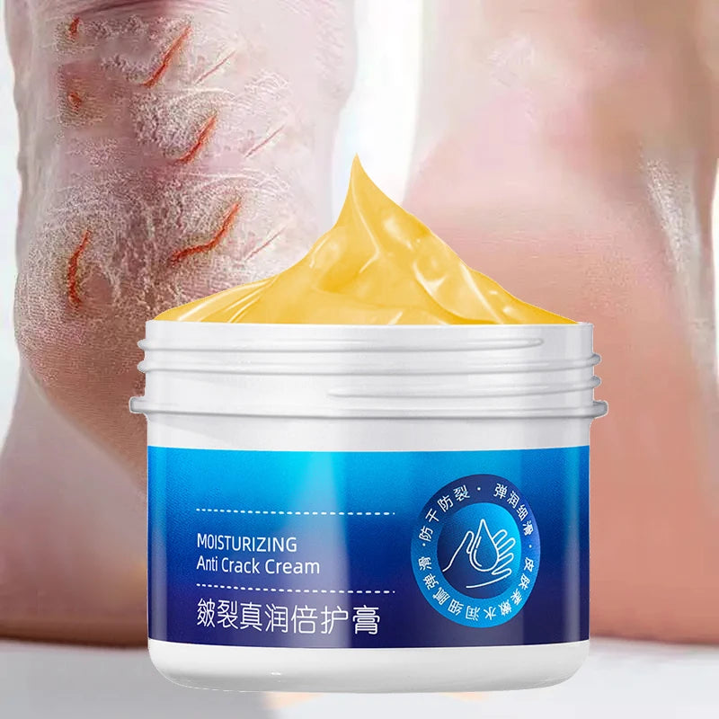 Anti-Drying Crack Hand Foot Care Cream Heel Cracked Repair Products Removal Dead Skin Moisturizing Whitening Nourish Skincare