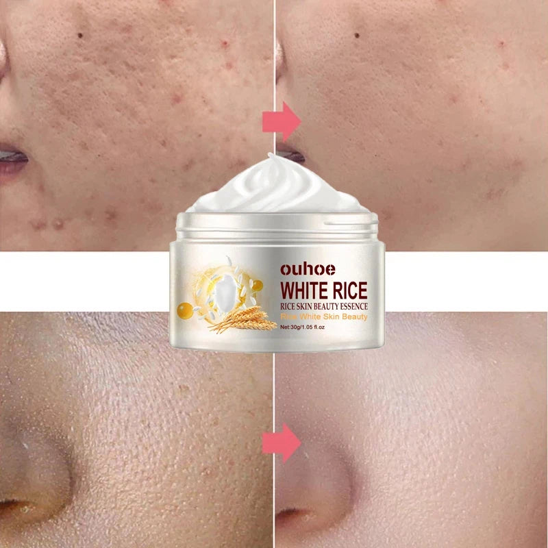 Rice Anti-wrinkle Facial Cream Acne Melasma Treatment Pigmentation Whitening Face Lifting Beauty