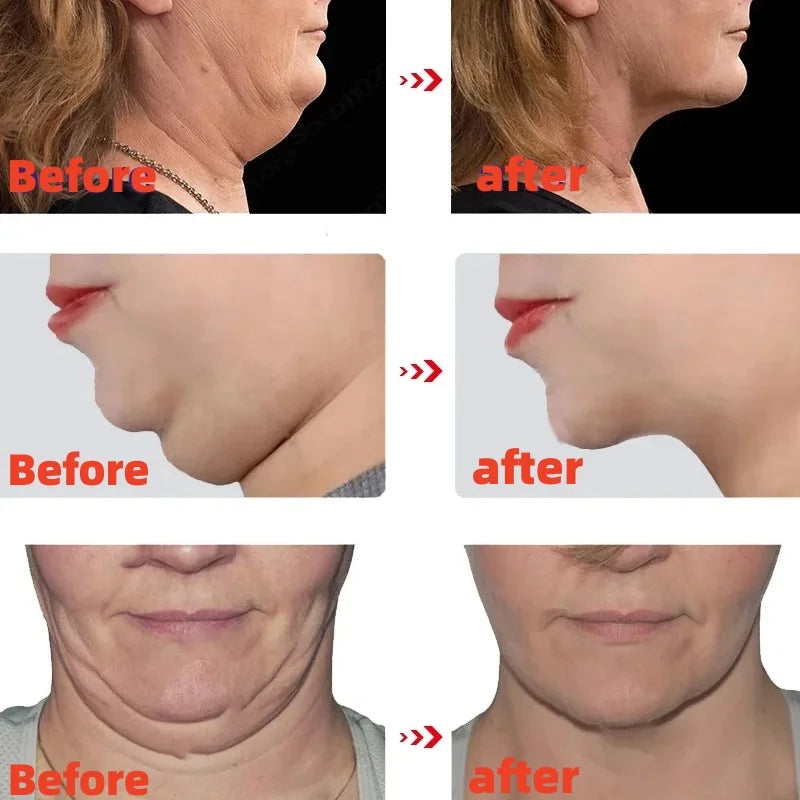 Slimming Cream Firming Face-lift Slimming Shaping Removal Face Fat Masseter Muscle Double ChinBurning Thin Face Products