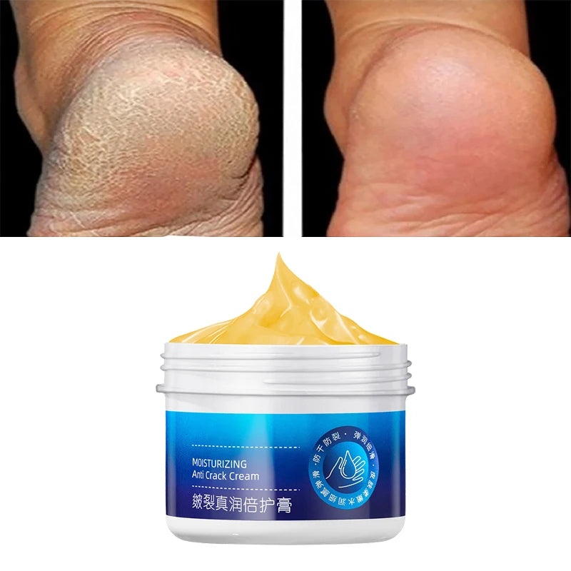 Anti-Drying Crack Hand Foot Care Cream Heel Cracked Repair Products Removal Dead Skin Moisturizing Whitening Nourish Skincare