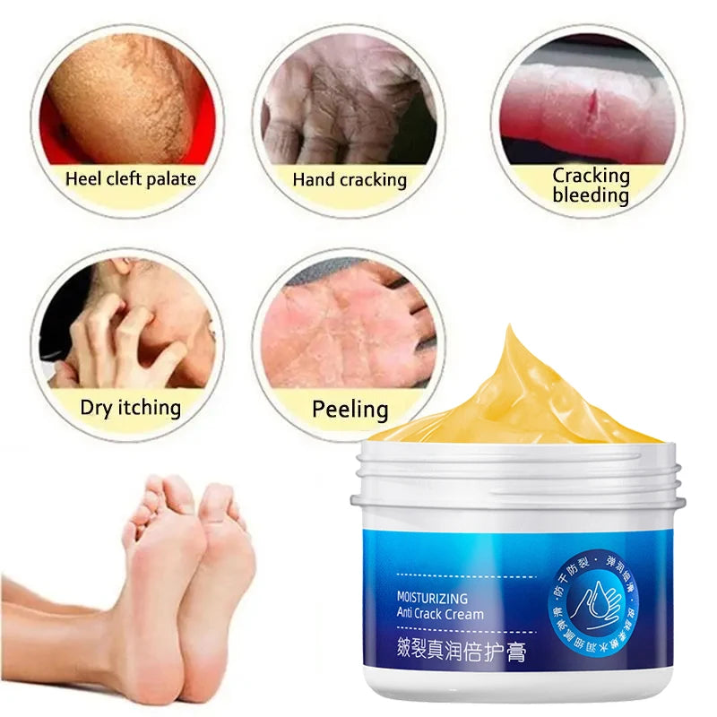 Anti-Drying Crack Hand Foot Care Cream Heel Cracked Repair Products Removal Dead Skin Moisturizing Whitening Nourish Skincare